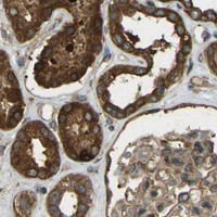 HPA IHC Kidney — TAP1