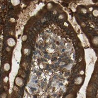 HPA IHC Colon — TAP1