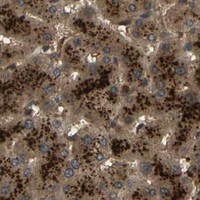 HPA IHC Liver — TAP1