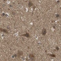 HPA IHC Cerebral cortex — TAP1