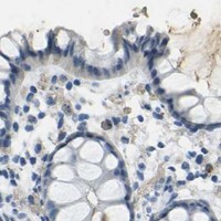 HPA IHC Colon — HBB
