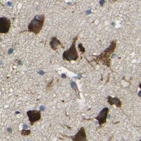 HPA IHC Cerebral cortex — RPSA