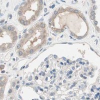 HPA IHC Kidney — SERPINB5
