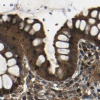 HPA IHC Colon — PLK2
