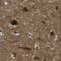 HPA IHC Cerebral cortex — PLK2