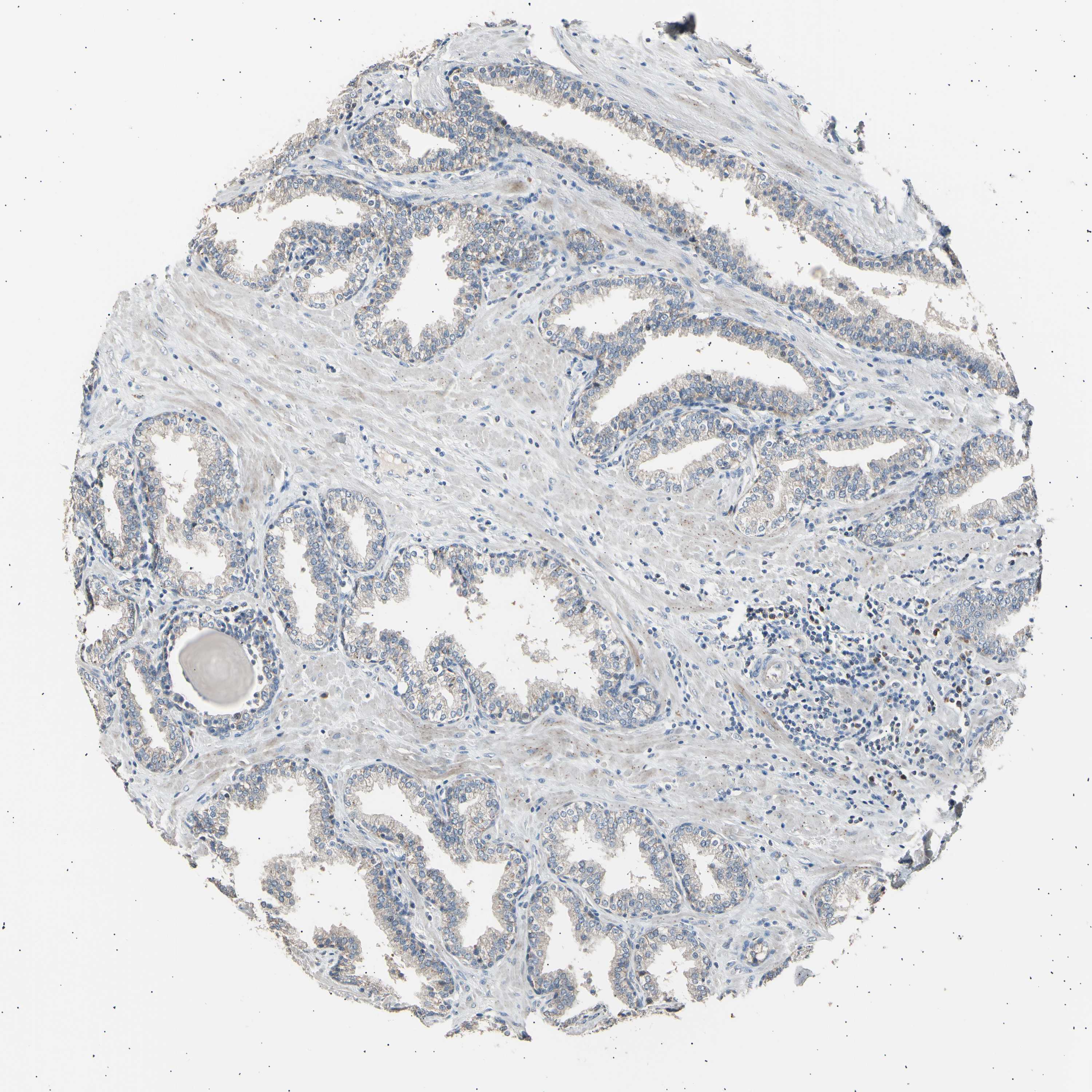 Tissue expression of LDLR Staining in prostate The Human Protein Atlas