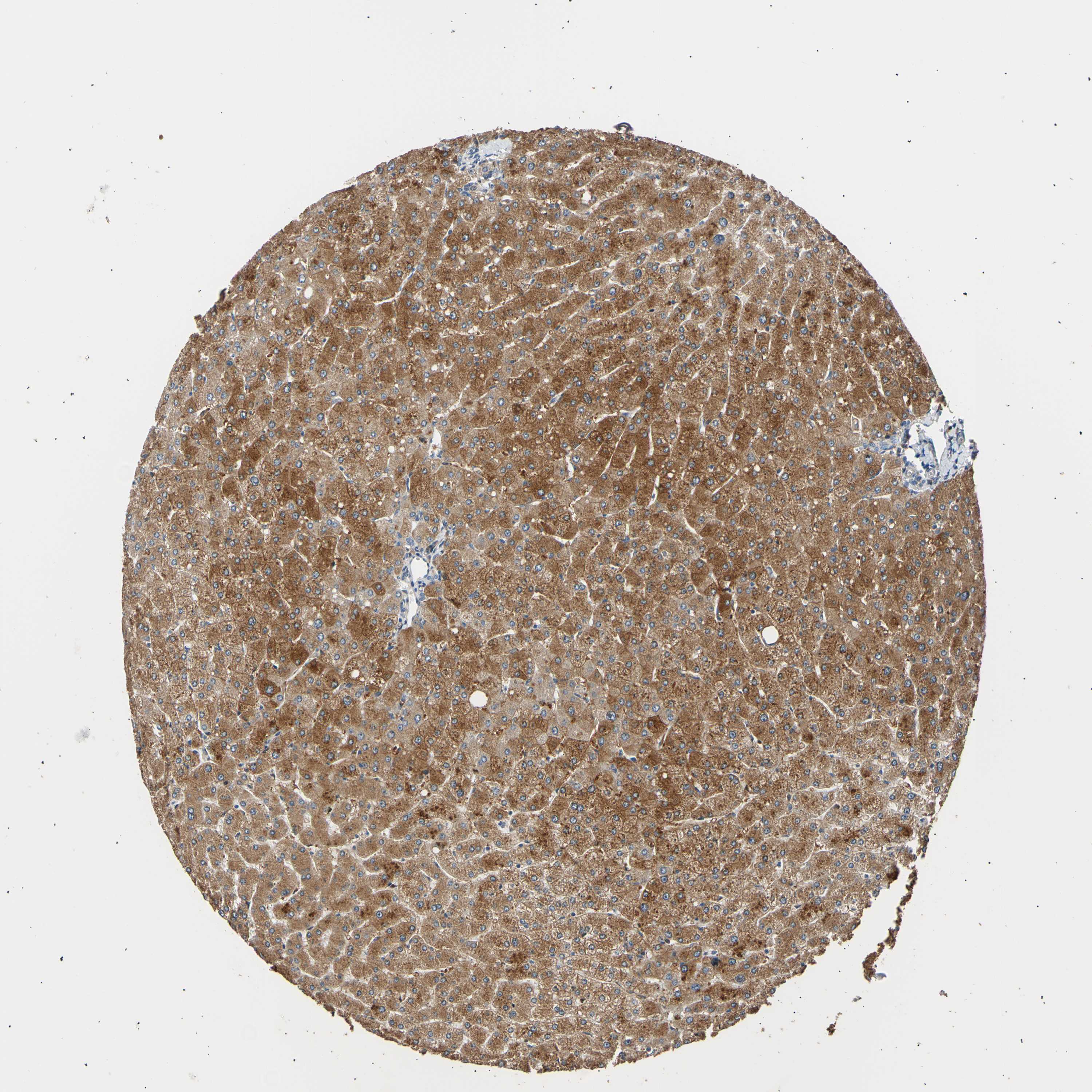 Tissue expression of LDLR Staining in liver The Human Protein Atlas