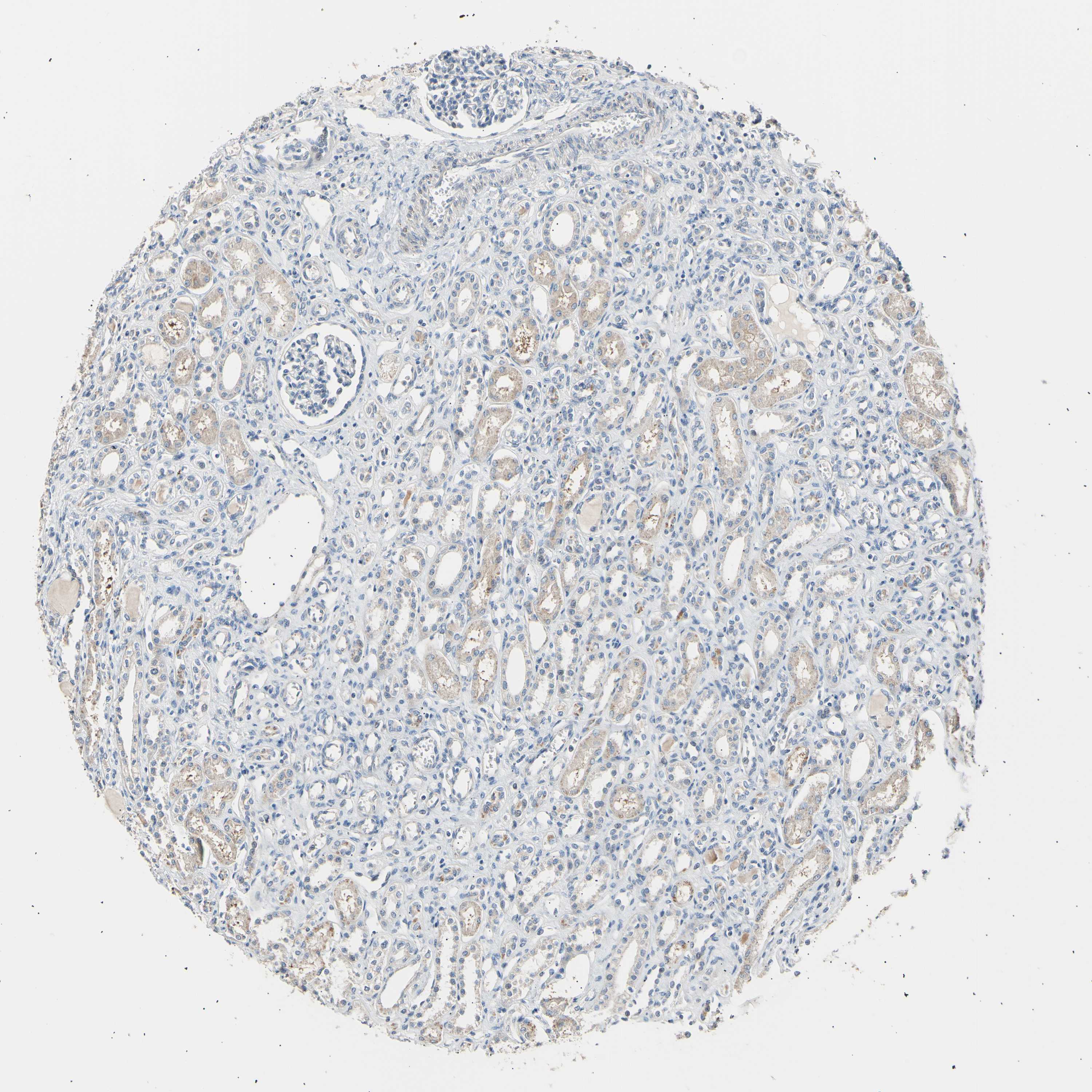 Tissue expression of LDLR Staining in kidney The Human Protein Atlas