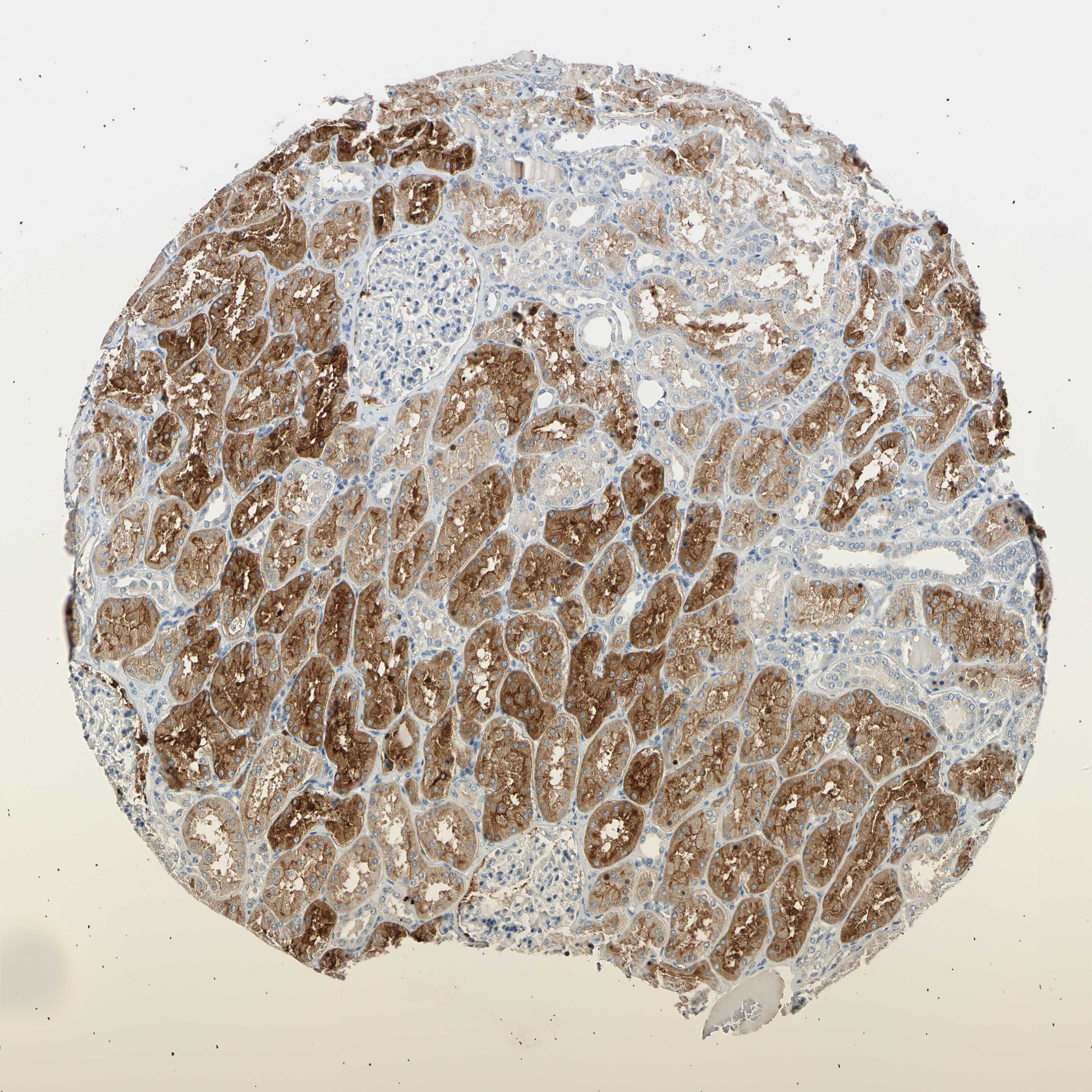Tissue expression of LDLR Staining in kidney The Human Protein Atlas