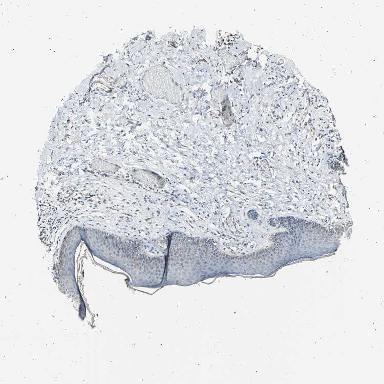 Tissue expression of LDLR Staining in skin The Human Protein Atlas