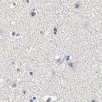 HPA IHC Cerebral cortex — LDLR