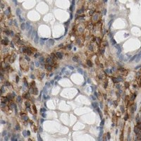 HPA IHC Colon — ANXA6