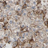 HPA IHC Liver — ANXA6