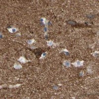 HPA IHC Cerebral cortex — ANXA6