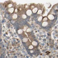 HPA IHC Colon — NDFIP1