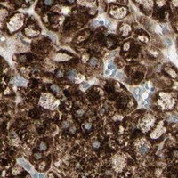 HPA IHC Adrenal gland — NDFIP1