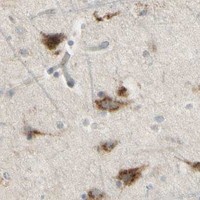 HPA IHC Cerebral cortex — NDFIP1