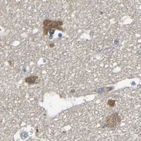 HPA IHC Cerebral cortex — CNR2