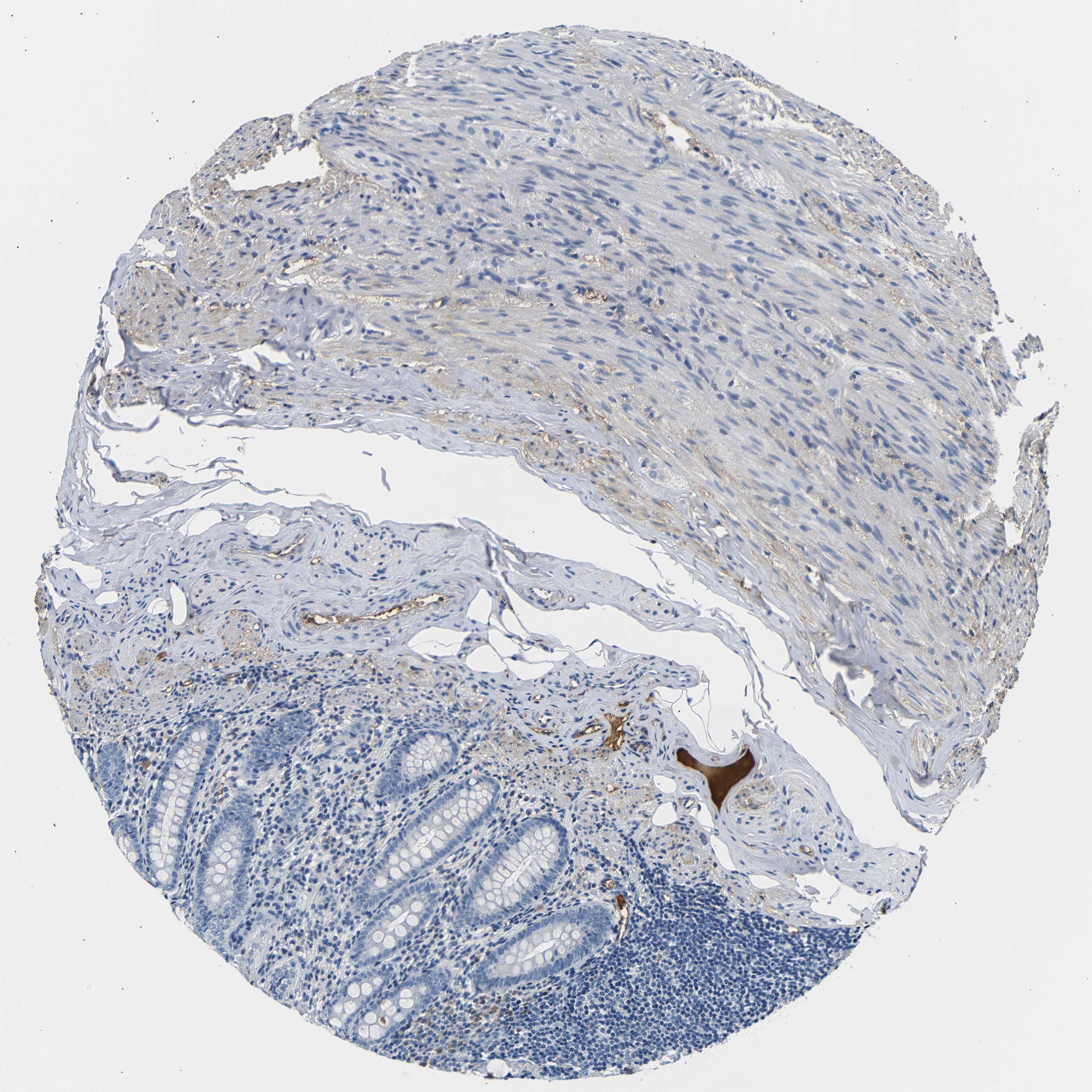 Tissue expression of LHCGR Staining in appendix The Human Protein Atlas