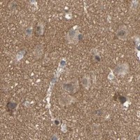 HPA IHC Cerebral cortex — NECTIN3