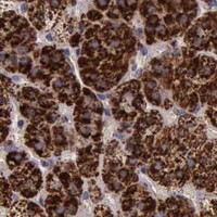 HPA IHC Adrenal gland — TXN2