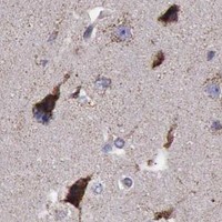 HPA IHC Cerebral cortex — TXN2